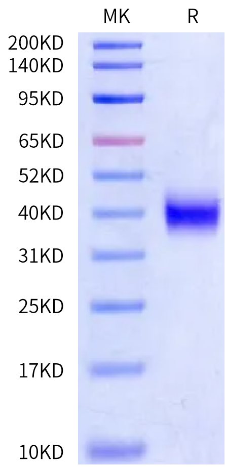 Human Kallikrein 11/KLK11 Protein (active form), Ultra Low Endotoxin (KLK-HM111-UL)