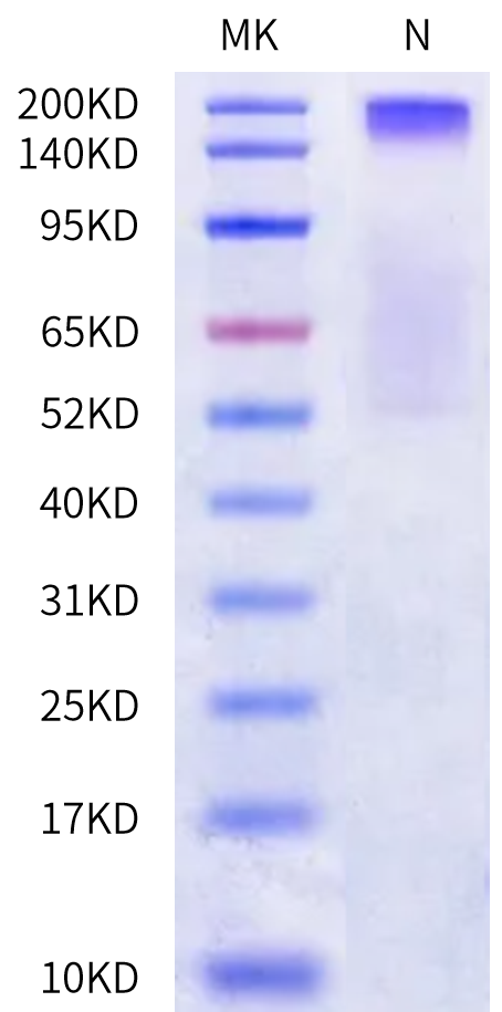 Human HLA-A*02:01&B2M&KKLC1 (ILNNFPHSI) Tetramer Protein (MHC-HM493T)