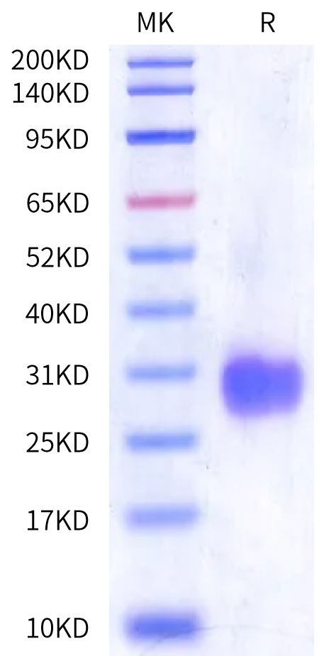 Mouse IL-25/IL-17E Protein (IL2-MM125)