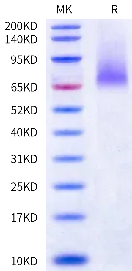 Rat ADAM9 Protein (ADM-RM119)