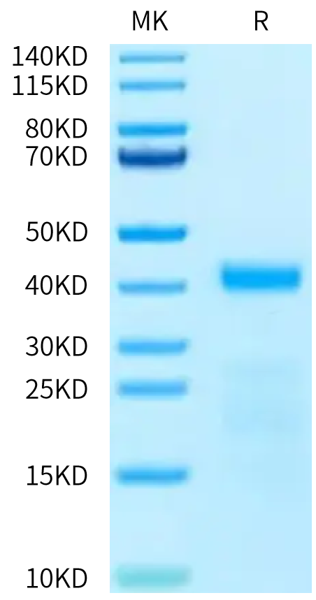 Mouse Kallikrein 5/KLK5 Protein (active form), Ultra Low Endotoxin (KLK-MM105-UL)