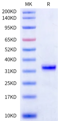 Human Kallikrein 3/PSA-Protein (active form) (KLK-HM13A)
