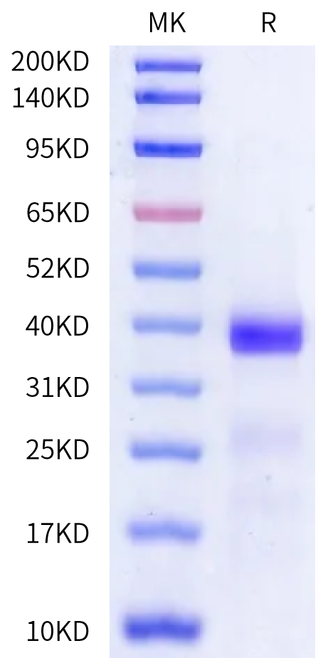 Human Kallikrein 12 Protein (active form), Ultra Low Endotoxin (KLK-HM112-UL)