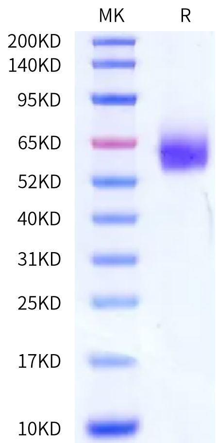Mouse uPAR/PLAUR Protein (PAR-MM101)