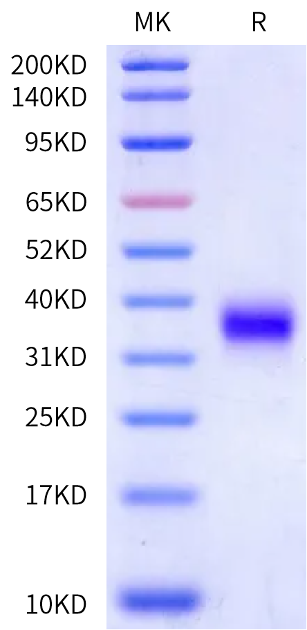Human Fc gamma RIIA/CD32a (H167) Protein (CDA-HM132)