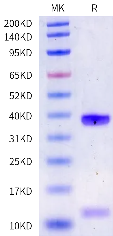 Human HLA-A*25:01&B2M&NUTM1 (DVYENFRQW) Monomer Protein (MHC-HE459)