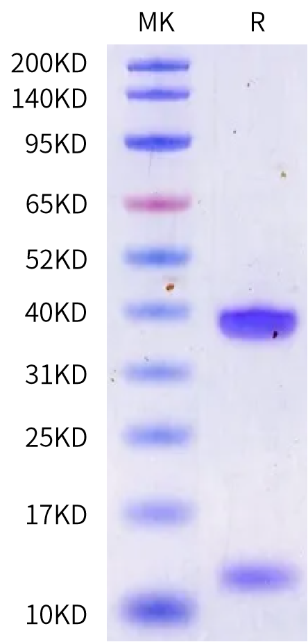 Biotinylated Human HLA-A*25:01&B2M&NUTM1 (DVYENFRQW) Monomer Protein (MHC-HE459B)