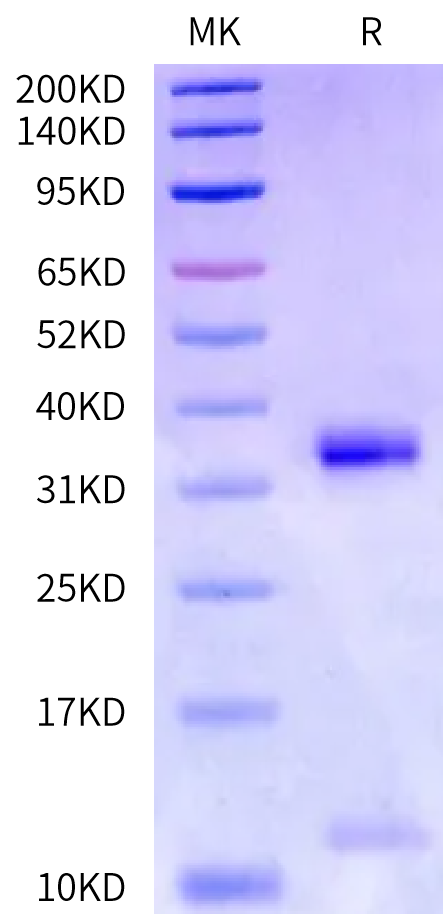 Human HLA-A*11:01&B2M&KRAS G12C (VVVGACGVGK) Monomer Protein (MHC-HE456)
