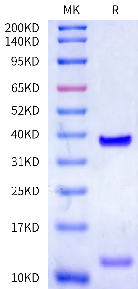 Biotinylated Human HLA-A*11:01&B2M&KRAS G12C (VVVGACGVGK) Monomer Protein (MHC-HE456B)