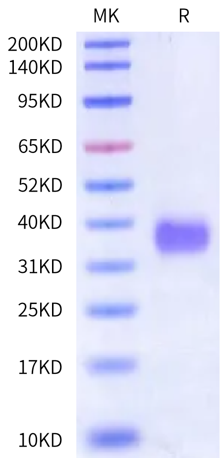 Human Fc gamma RIIA/CD32a (R167) Protein (FCR-HM124)