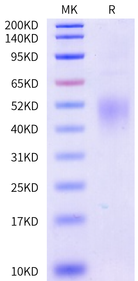 Biotinylated Mouse CD74/DHLAG Protein (Primary Amine Labeling) (CD7-MM175B)