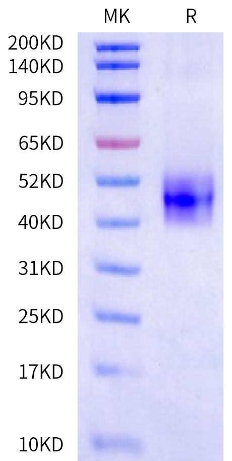 Biotinylated Human Fibronectin (32-345) Protein (Primary Amine Labeling) (FIN-HM101B)