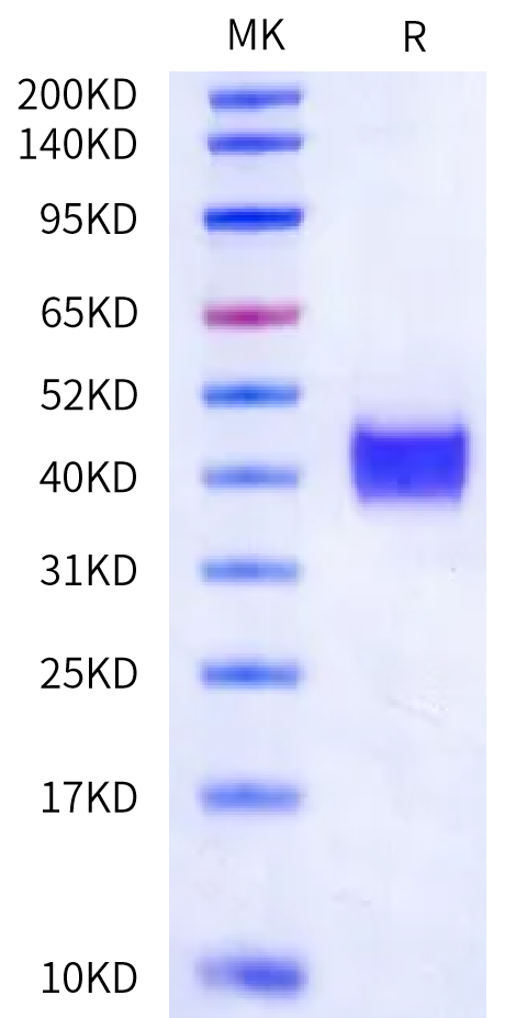Human Kallikrein 9 Protein (pro form) (KLK-HM119)