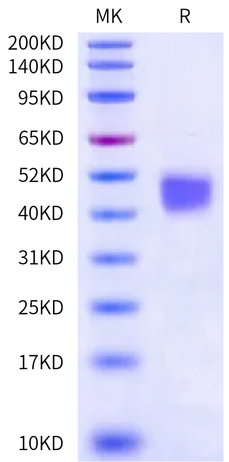 Rat IL-4 R alpha/CD124 Protein (ILA-RM14R)