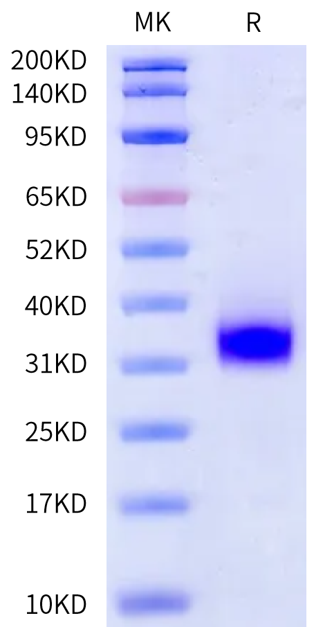 Rat IL-6 Protein (IL6-RM106)
