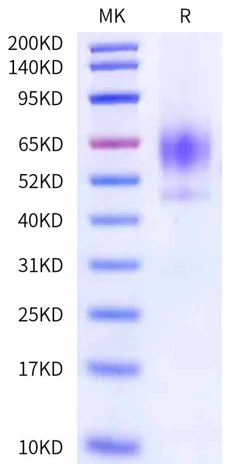 Human LRP2 (1025-1349) Protein, Ultra Low Endotoxin (LRP-HM622-UL)