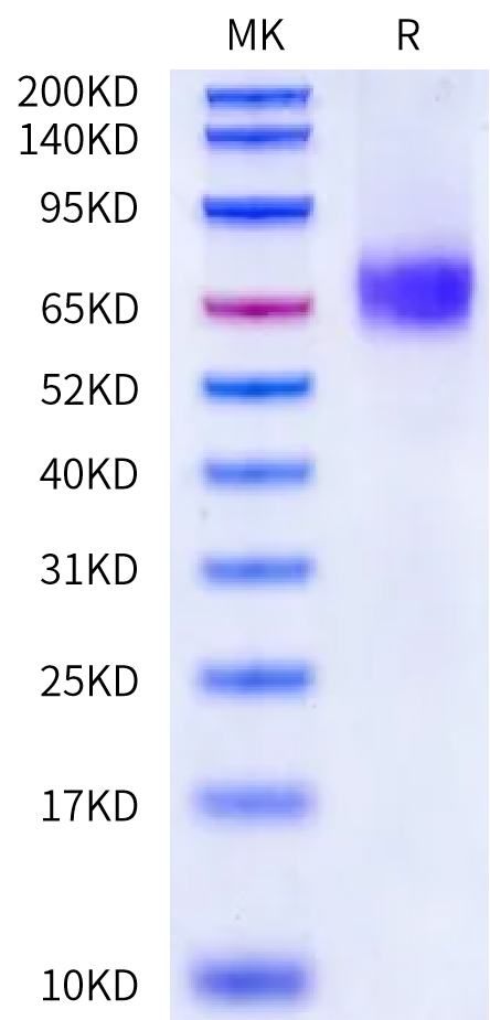 Human LRP2 (3511-3963) Protein (LRP-HM624)