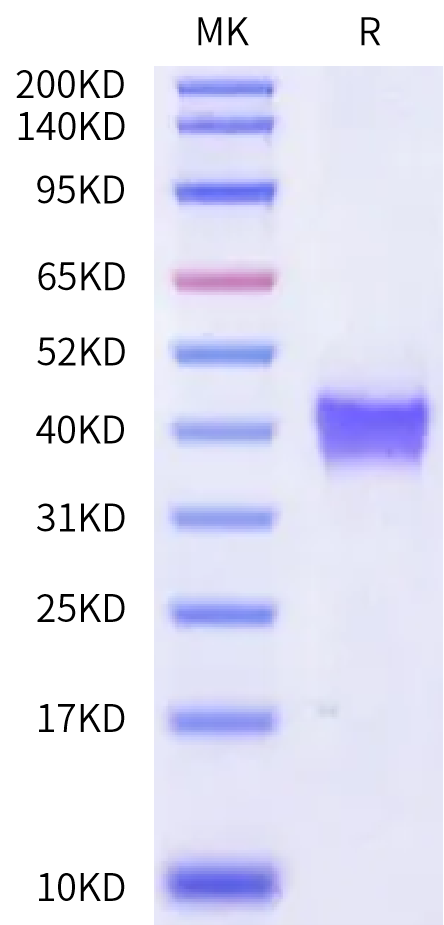 Rat Kallikrein 2/KLK2 Protein (KLK-RM102)