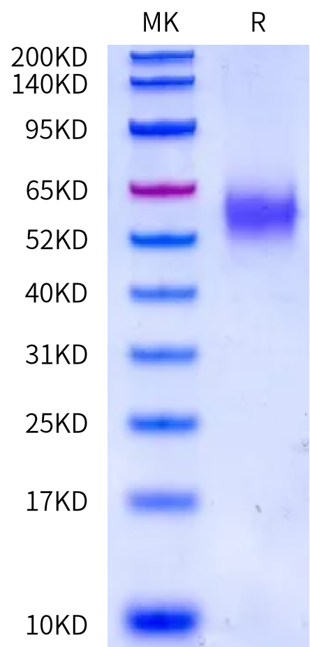Human LRP2 (27-308) Protein (LRP-HM621)
