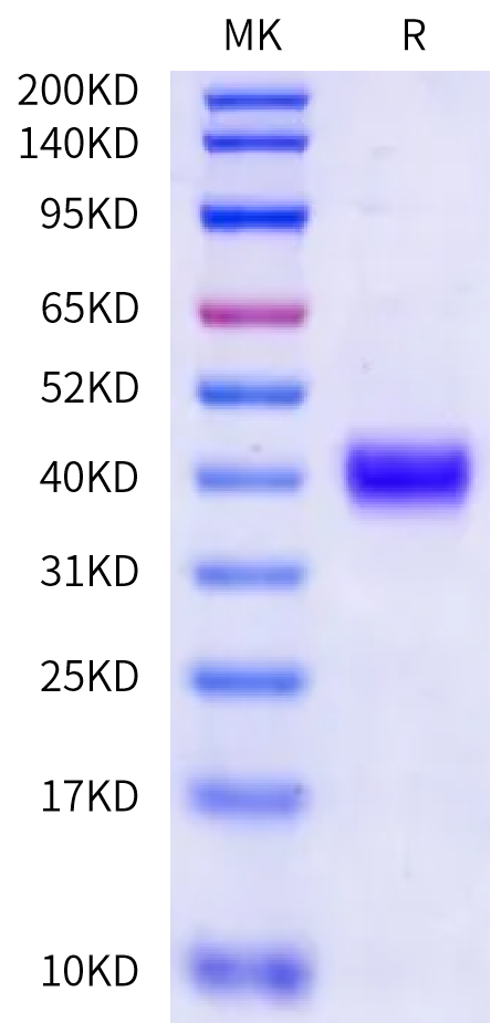 Rat PRLR Protein (PLR-RM101)