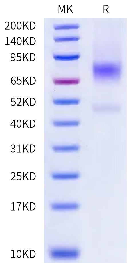 Human LRP2 (2699-3111) Protein (LRP-HM623)