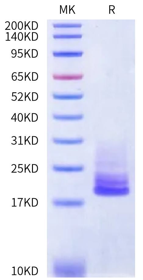Human CDH6/Cadherin 6 EC3 Domain Protein (CDH-HM1E3)
