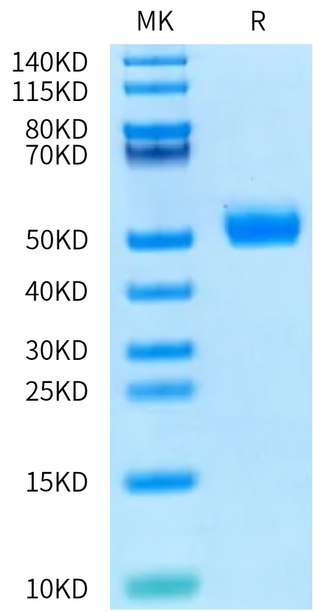 Human Prostatic Acid Phosphatase Protein (ACP-HM101)