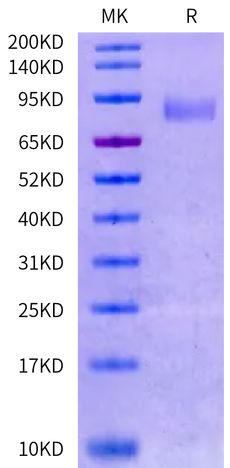 Human CDH6/Cadherin 6 (EC3del) Protein (CDH-HM1D3)