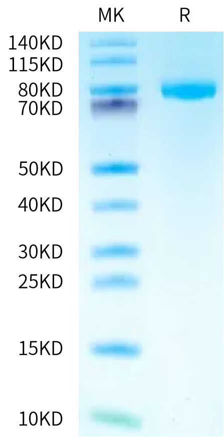 Human SLITRK6 Protein (SRK-HM106)