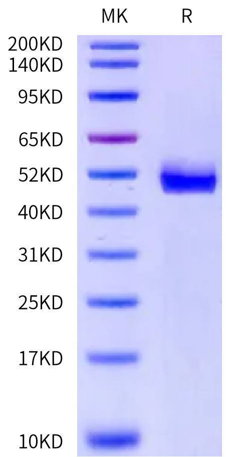 Human Prostatic Acid Phosphatase Protein (ACP-HM102)