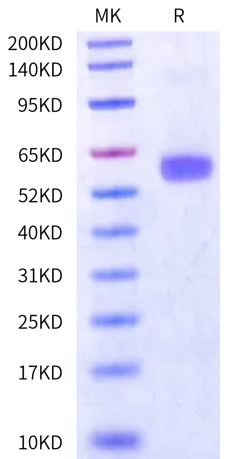Human IL-7 R alpha/CD127 Protein (IL7-HM2RD)