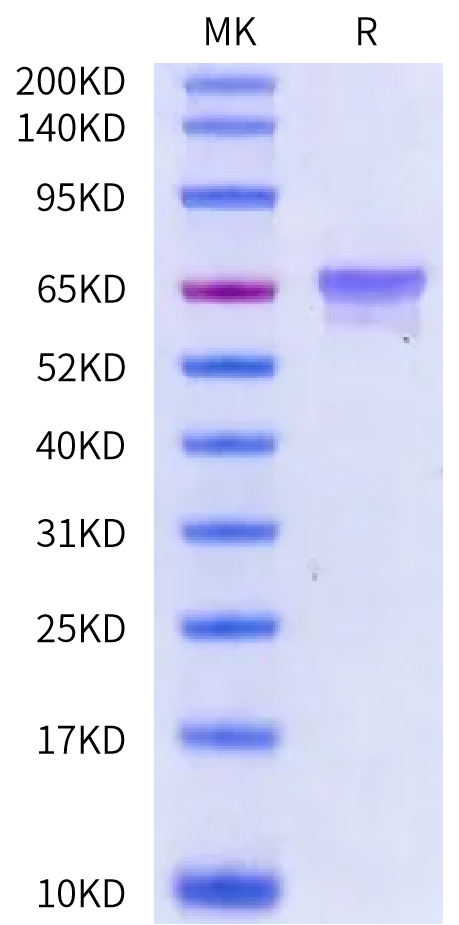 Human Tau-441/2N4R Protein (TAU-HE041)