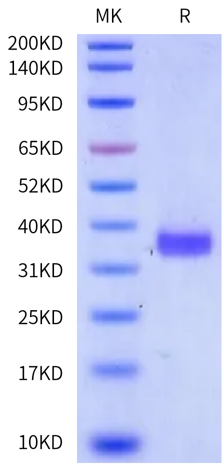 Human Kallikrein 8/KLK8 Protein (pro form) (KLK-HM118)