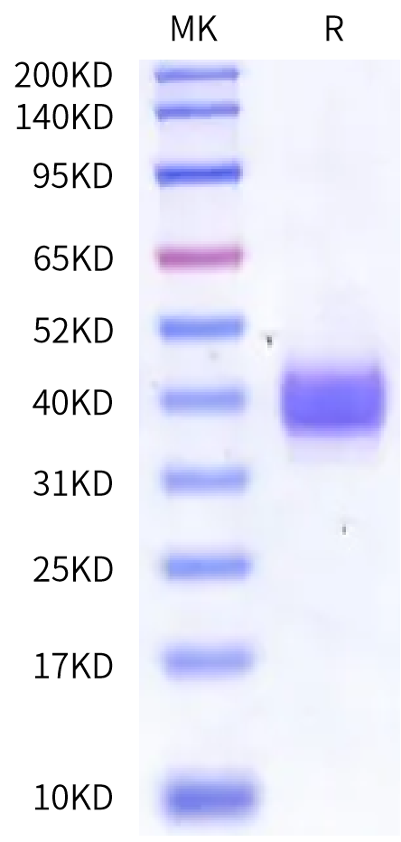 Human Kallikrein 12 Protein (pro form) (KLK-HM120)