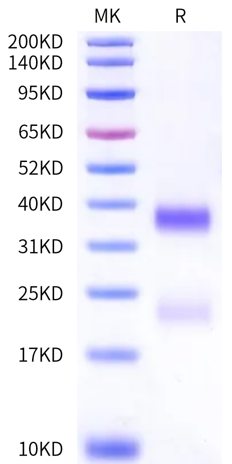 Human RGM-B Protein (RGM-HM10B)