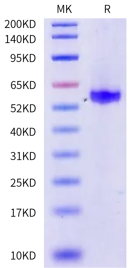 Human Coagulation factor VII /F7 Protein (pro form) (CF7-HM107)