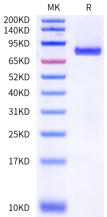 Mouse PADI4 Protein (PAD-ME104)