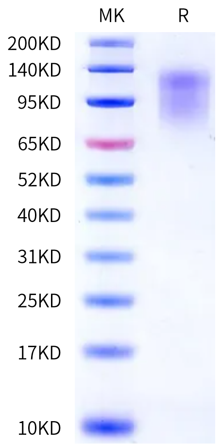 Human CEACAM-5/CD66e (35-498) Protein (CAM-HM1D4)