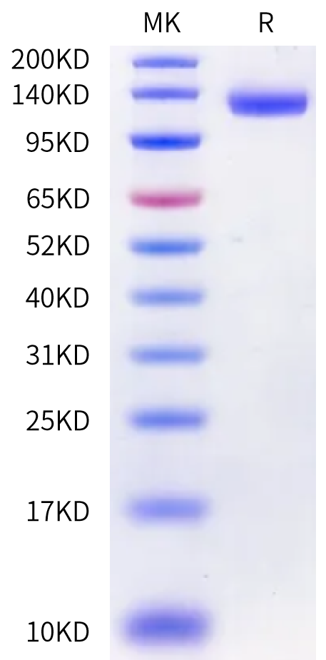 Felis catus OSMR beta Protein (OSM-FM10R)