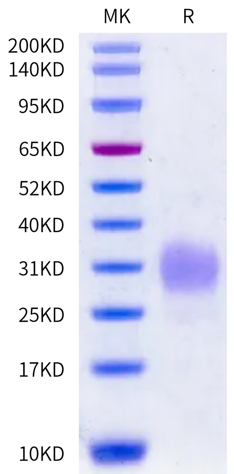 Felis catus IL-31 Protein (IL3-FM131)