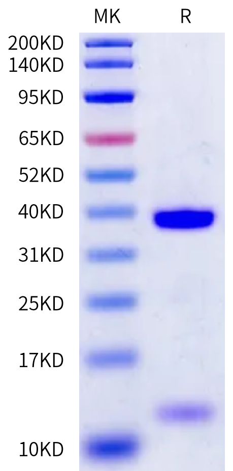 Biotinylated Human HLA-A*01:01&B2M&CT83 (NTDNNLAVY) Monomer Protein (MHC-HE465B)