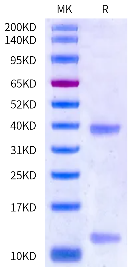 Biotinylated Human HLA-A*01:01&B2M&MAGE-A3 (EVDPIGHLY) Monomer Protein (MHC-HE461B)