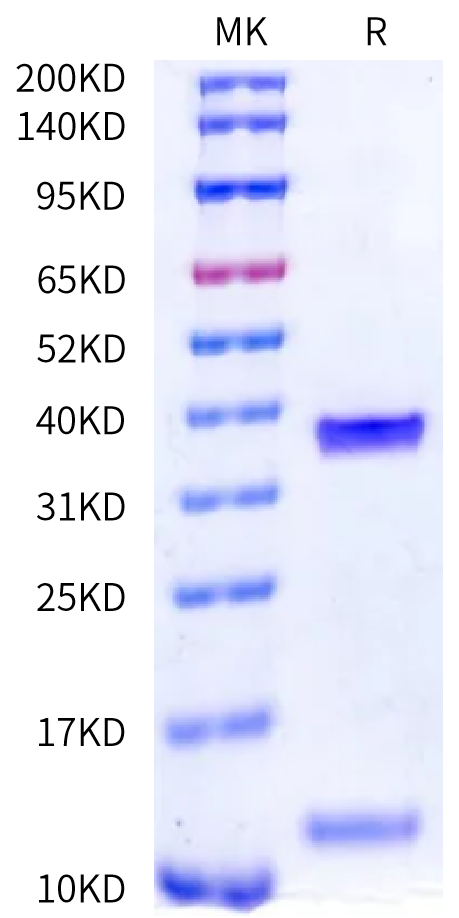 Human HLA-A*02:01&B2M&HBV c18V (FLPSDFFPSV) Monomer Protein (MHC-HE462)