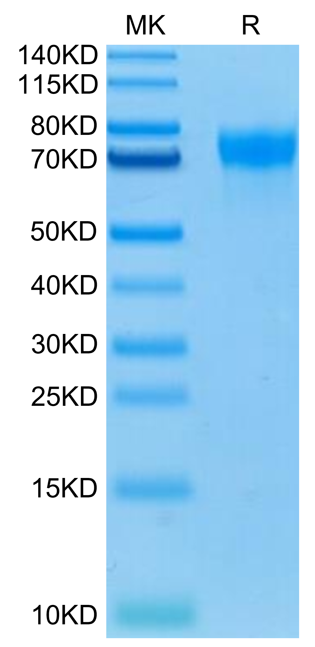 Biotinylated Human LILRA1/CD85i/LIR-6 Protein (LIL-HM4A1B)