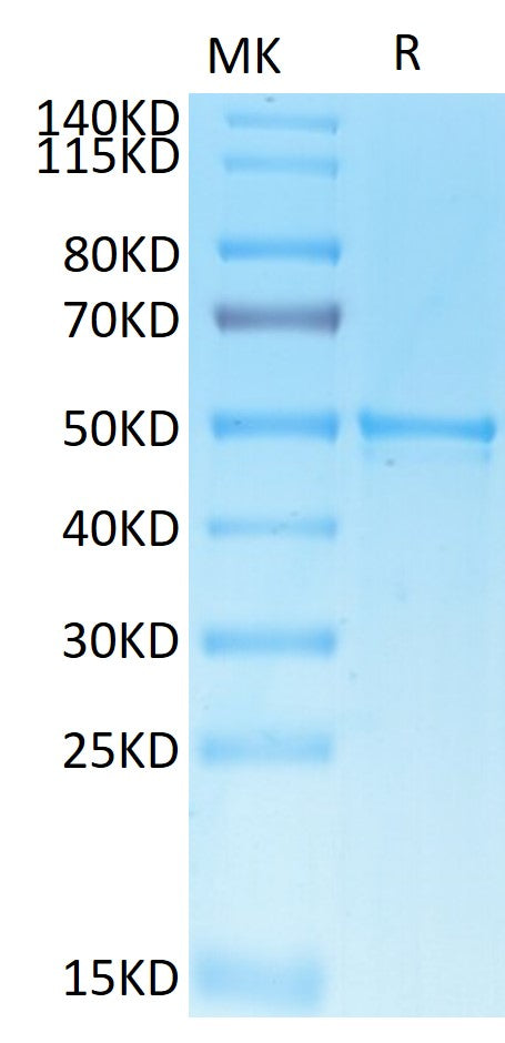 SARS-COV-2 Nucleocapsid Protein (COV-VE4NP)