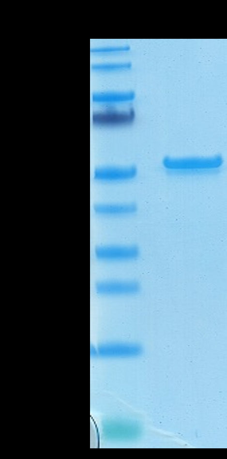 Bioytinylated SARS-COV-2 Nucleocapsid Protein (COV-VE4NPB)