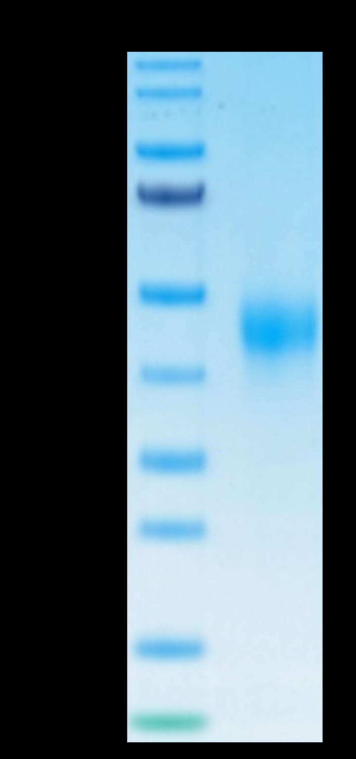 Biotinylated Human TFPI Protein (TFP-HM401B)