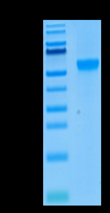 Human Siglec-8 Protein (SIG-HM408)