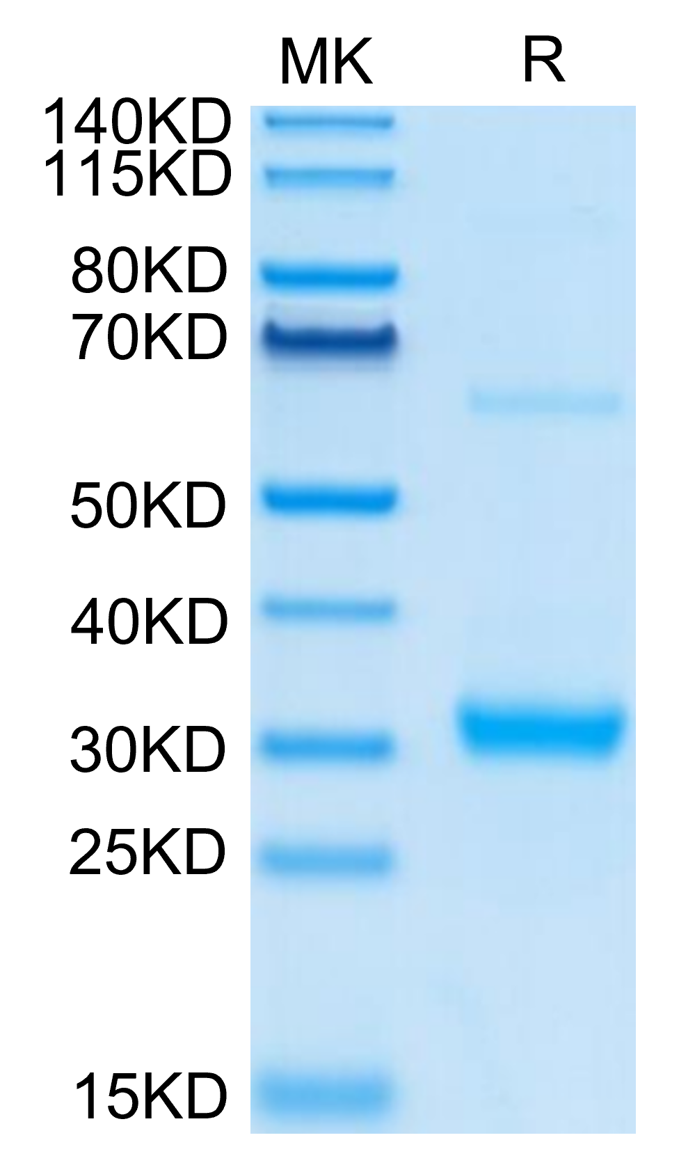 Human CLEC10A Protein (CLE-HM10A)