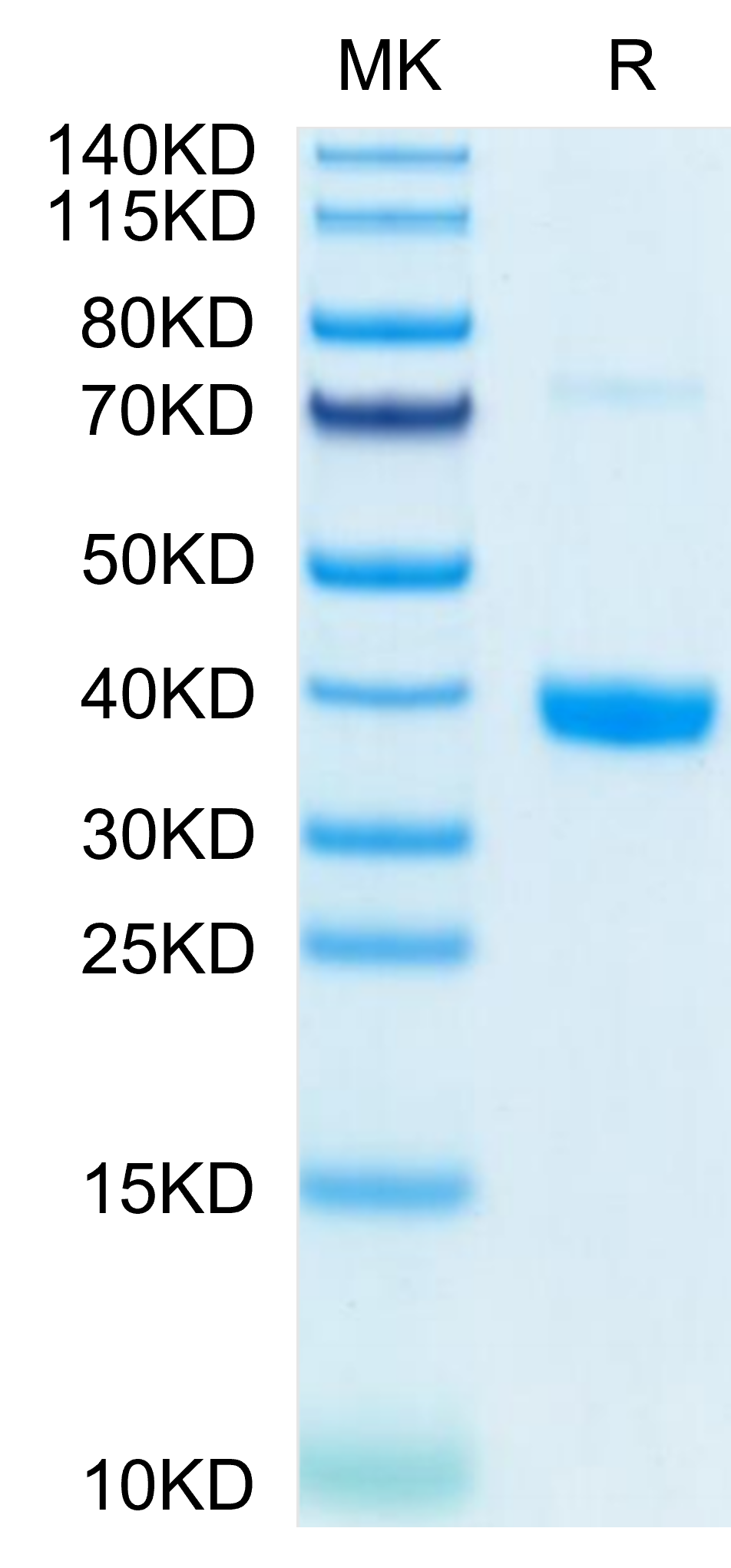 Mouse MFAP4 Protein (MAP-MM104)